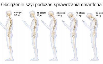 BLOG smsowy kark 400x250 - BLOG