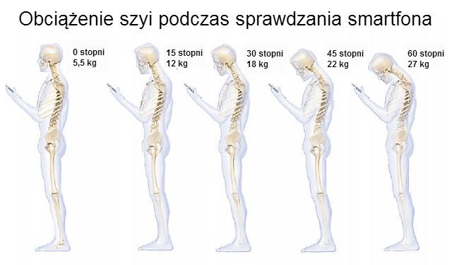 Text Neck Syndrome czyli „sms-owy kark”