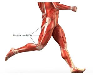 ITBS, czyli syndrom pasma biodrowo – piszczelowego