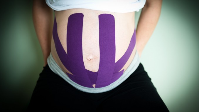 Kinesiology taping u&nbsp;kobiet w&nbsp;ciąży i&nbsp;po&nbsp;porodzie