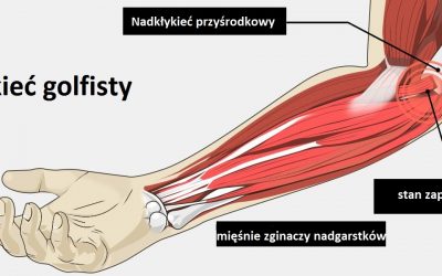 BLOG łokieć golfisty anatomia 400x250 - BLOG