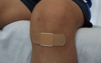 TERAPIA BLIZN umiejscowienie blizny a proces gojenia 400x250 - TERAPIA BLIZN