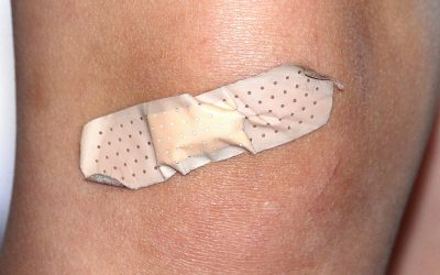TERAPIA BLIZN swedzaca rana 400x250 - TERAPIA BLIZN