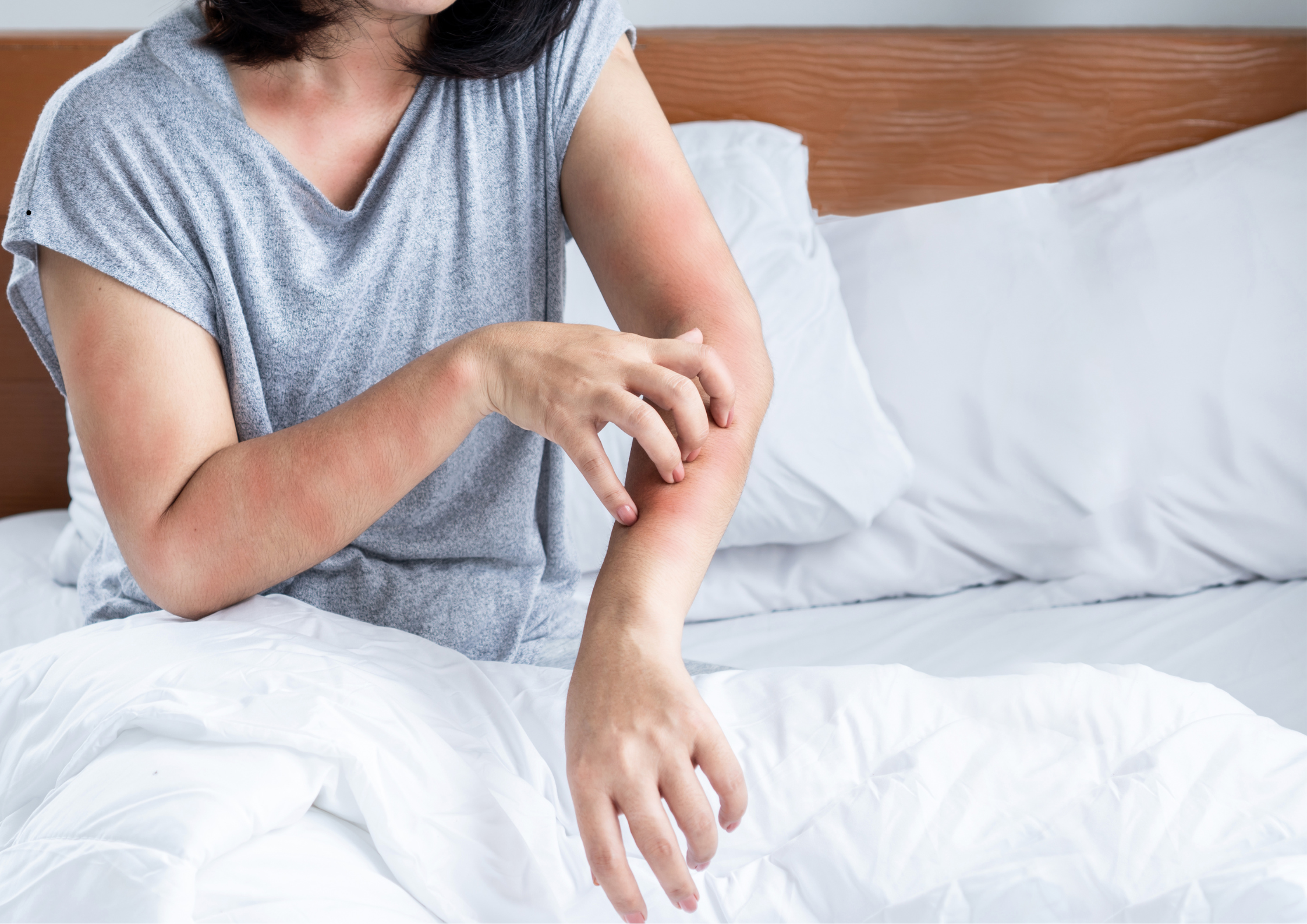 STREFA AROMATERAPII Reakcje drazniace i alergiczne na olejki eteryczne - STREFA AROMATERAPII